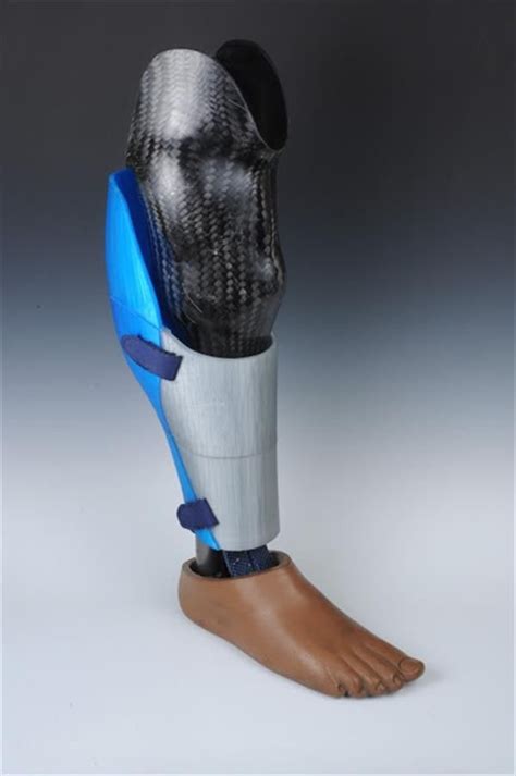 3D printed prosthetic leg covering takes e-NABLE to 'Next Step', scoops $10K prize | Prosthetic ...