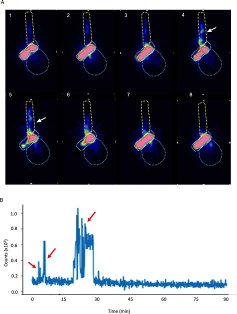 Reflux events on a gastric emptying study. A Serial images of gastric... | Download Scientific ...