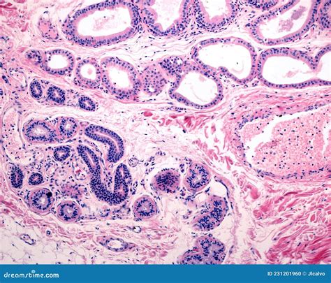 Comparison Between Eccrine And Apocrine Sweat Glands Stock Photo ...