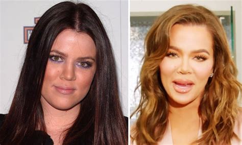 Khloe Kardashian Before And After: Old Photos That Show Off Her ...