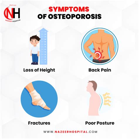 Early Symptoms of Osteoporosis - Nazeer Hospital