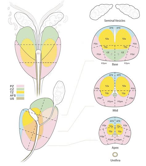 Prostate Gland Anatomy Mri