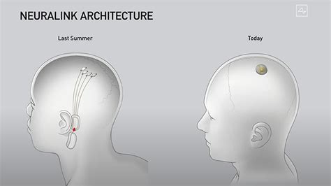 Elon Musk demos Neuralink implant in pigs, Ellipsis Health's vocal ...