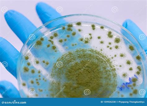 Aspergillus Oryzae is a Filamentous Fungus, Under the Microscope in ...