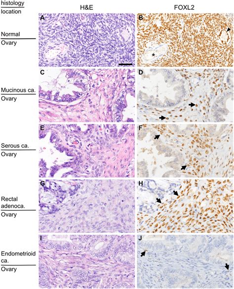 Distribution of FOXL2-positive stromal cells in the ovary. (A and B)... | Download Scientific ...