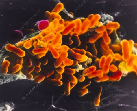 Rickettsia prowasekii bacteria - Stock Image B220/0521 - Science Photo ...