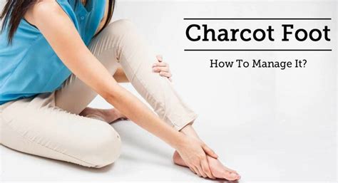 Charcot Foot: Symptoms, Causes, and Treatments | Diabetes Care