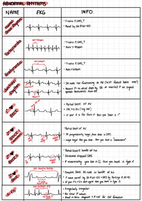 Abnormal ECG Rhythms | Nursing school notes, Nursing notes, Medical surgical nursing