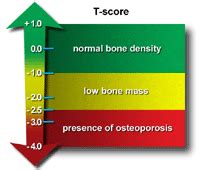 Bone Densitometry | Johns Hopkins Medicine