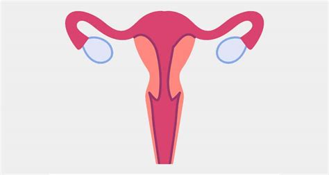 Symptoms and complications of ovarian cyst