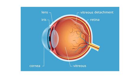 Give the difference between aqueous humor and vitreous humor