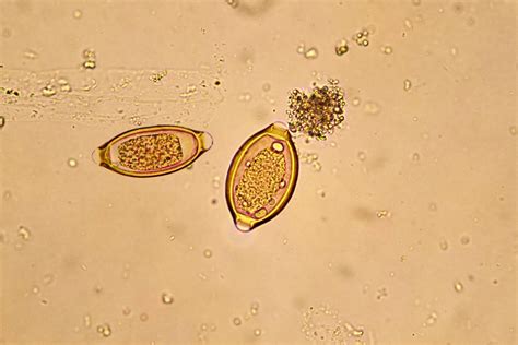 Wellcome Sanger Institute research uncovers how parasitic whipworms are able to thrive in our guts