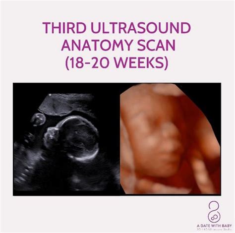 Gender 3D Ultrasound 18 Weeks - What to expect? Boy vs Girl