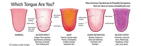 Stick Out Your Tongue! Understanding Chinese Tongue Diagnosis