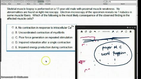 412 FUNCTION OF T TUBULES - YouTube