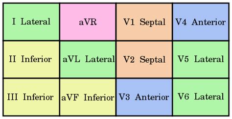 Acute STEMI Management - Mnemonic based approach | Epomedicine