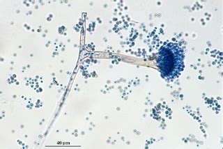 MBBS Medicine (Humanity First): Microscopic morphology of Aspergillus