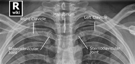 Pin by Jeremy Enfinger on Nursing | Radiology student, Radiology schools, Human anatomy and ...