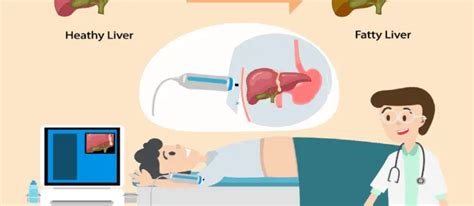 What is FibroScan Procedure? - MediCure