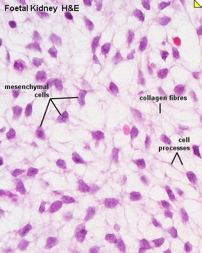 36 best images about Connective Tissue on Pinterest | Heart disease, Mast cell and Plays