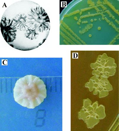 Pseudomonas stutzeri - microbewiki