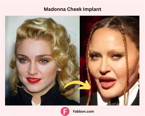 Madonna Plastic Surgery Secrets - Revealed | Fabbon