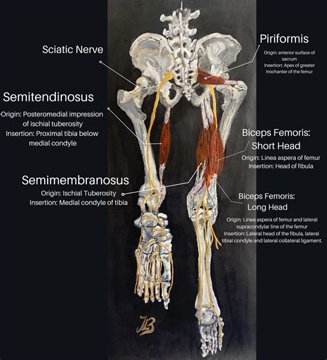 Differentiation of Hamstring Tendonitis and Strains Vs. Hamstring Syndrome.