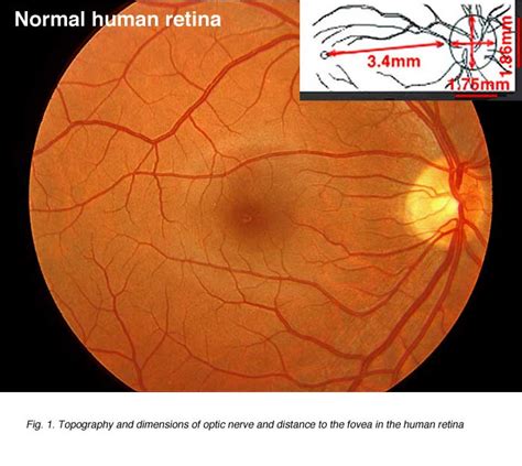 Facts and Figures concerning the human retina. Helga Kolb - Webvision