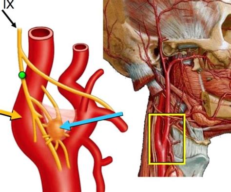 Location and innervation schematic of a paraganglioma (CBT) and its... | Download Scientific Diagram