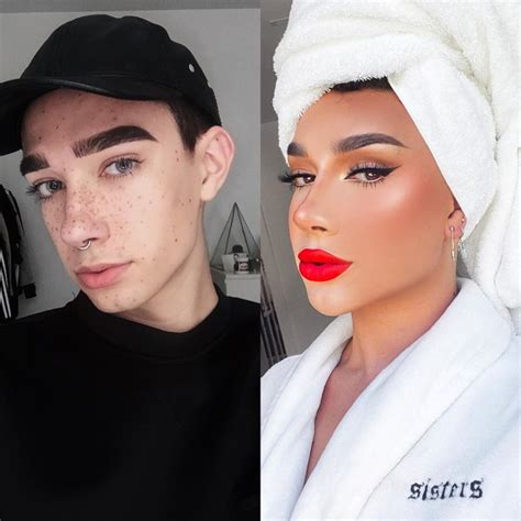 James Charles Plastic Surgery: YouTuber Reveals Procedures