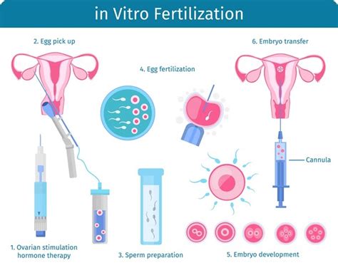 In Vitro Fertilization (IVF): History, Side Effects and Risks-----On Fow24news.com(Health ...