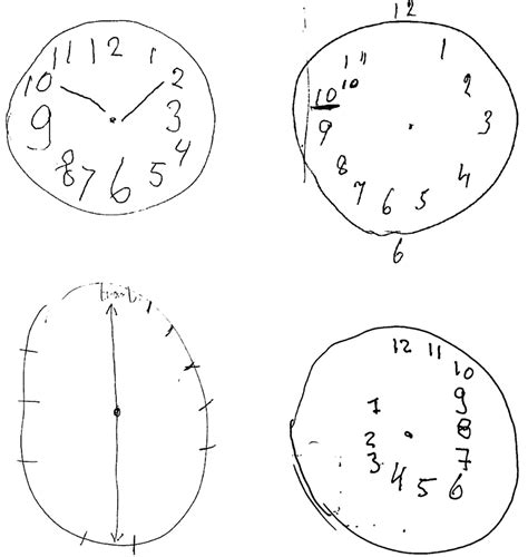 Psychiatric Test Drawing A Clock – Warehouse of Ideas