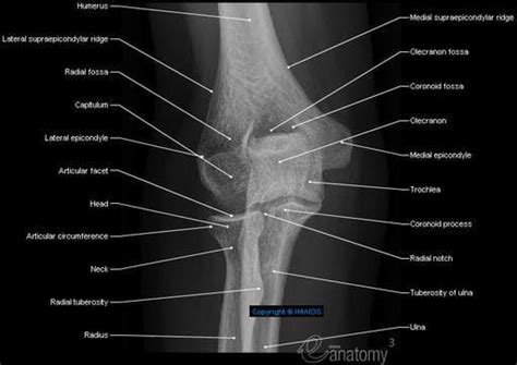 Radiological anatomy of the shoulder, arm, elbow, forearm, wrist, hand ...