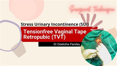 Tensionfree vaginal tape - Retropubic | TVT - Retropubic | Mid urethral sling (MUS) | TVT for ...