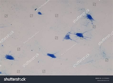 Motor Neuron Nerve Cells Under Microscope Stock Photo 2112769463 ...