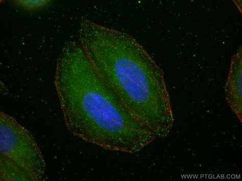 mTOR antibody (81670-1-RR) | Proteintech