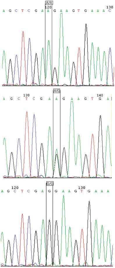 Representative electropherogram showing sequencing analysis of serpin ...