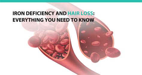 Iron Deficiency and Hair Loss: Everything You Need to Know - Advanced Medical Hair Institute ...