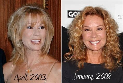 Kathie Lee Gifford Plastic Surgery Before And After Photos