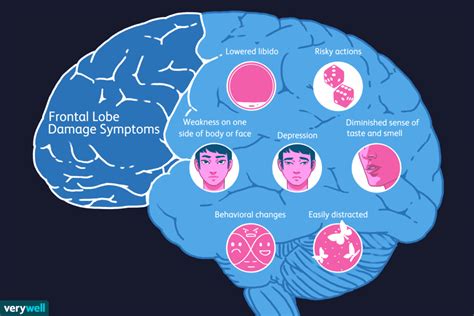 An Overview of Frontal Lobe Damage - How Frontal Lobe Brain Injury Can ...