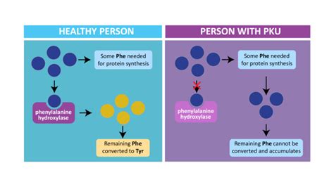 Phenylketonuria (PKU)- Treatment, Prevention, Dietary management ...