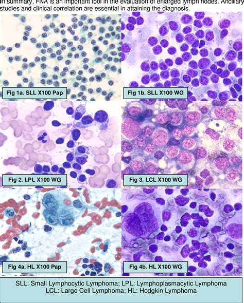 Pdf Role Of Fine Needle Aspiration Cytology In The Diagnosis Of | My XXX Hot Girl