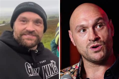 Tyson Fury sports bruising black eye ahead of huge Oleksandr Usyk boxing fight