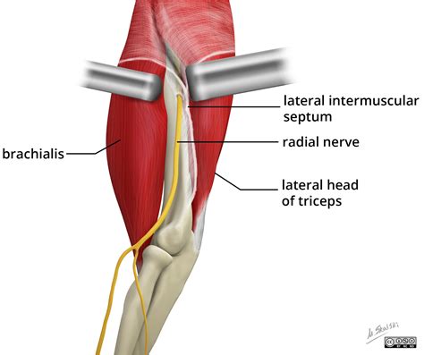 Radiopaedia - Drawing Radial nerve at humerus lateral view - English labels | AnatomyTOOL