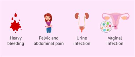 What are the signs and symptoms of recurrent miscarriage?