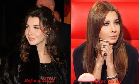 Nancy Ajram Plastic Surgery Before And After Photos