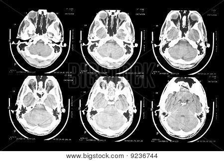 Ct Scan Brain Image & Photo (Free Trial) | Bigstock