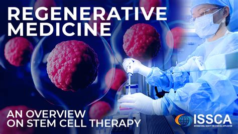 Regenerative Medicine – An Overview On Stem Cell Therapy - ISSCA ...