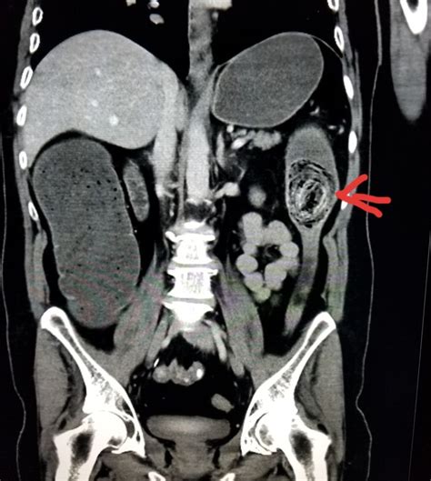 Pin by Marusic on radiol | Radiology, Interventional radiology, Pet ct