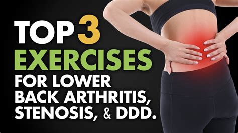 Where is lower back arthritis pain felt? - Health Blog